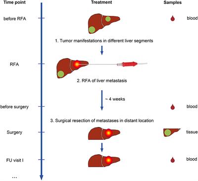 A Non-interventional Clinical Trial Assessing Immune Responses After Radiofrequency Ablation of Liver Metastases From Colorectal Cancer